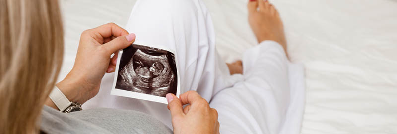 Ultrasound Image Ultrasound Image